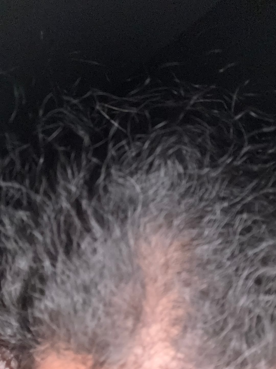 Customer photo review of Hair Loss Prevention Kit