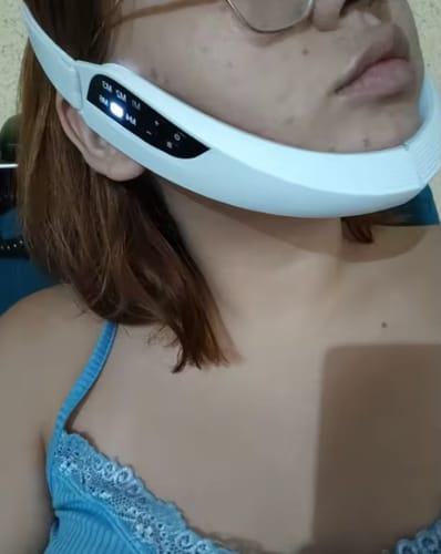 Customer photo review of ALISSEA V-SCULPT™  Dispositivo lifting facial EMS- LED tecnology