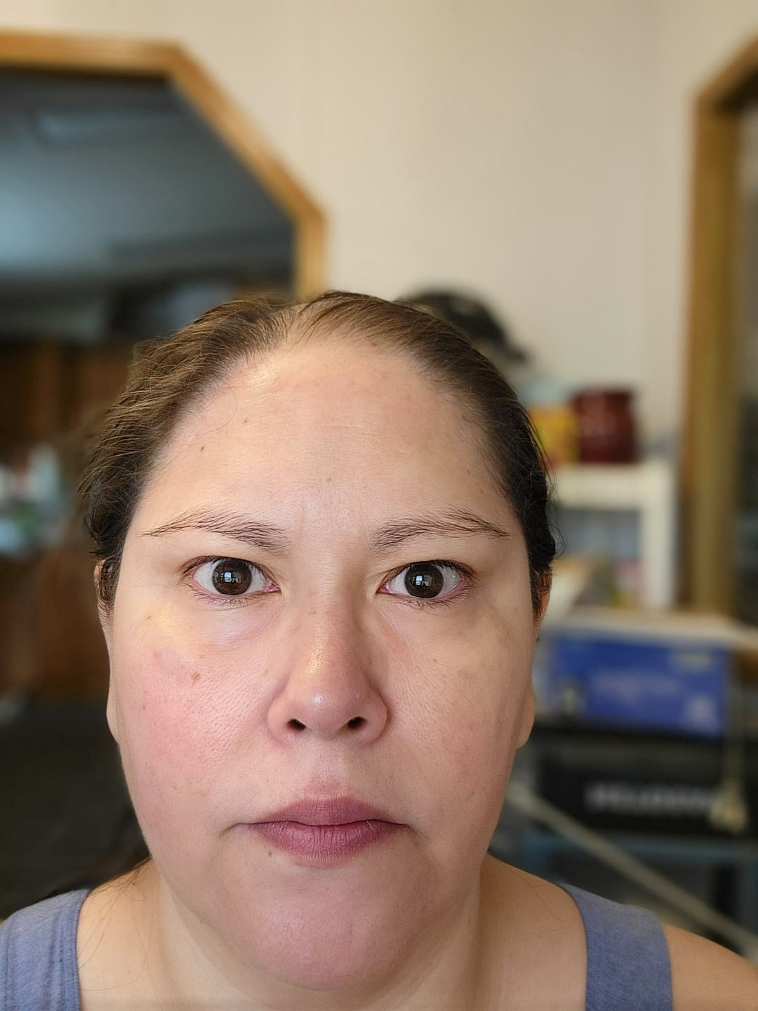 Customer photo review of 6 Month Supply - Deep Collagen Cream