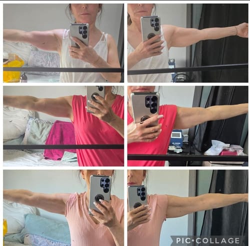 Customer photo review of 2026 Adonis™ II 40K 6 in 1 Cavitation Machine for Fat Blasting