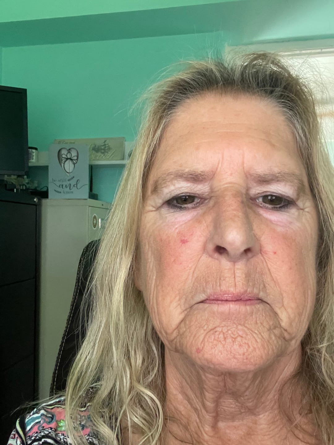 Customer photo review of Deep Collagen Cream