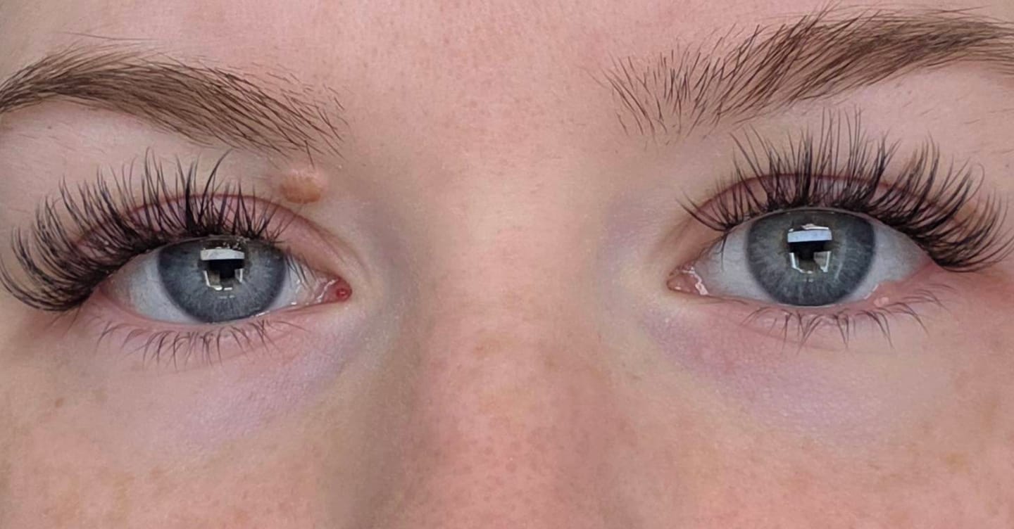 Customer photo review of THE CANCER (Krebs 5-11 mm)