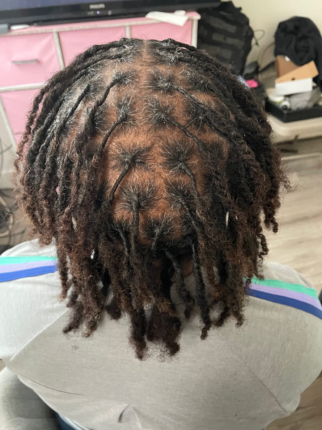 Customer photo review of Scalp Stimulator | Hair Growth Oil