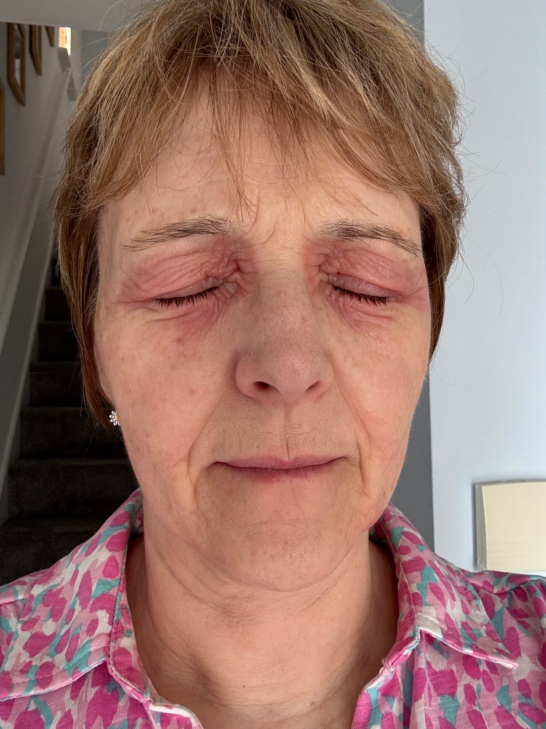 Customer photo review of Calm Balm