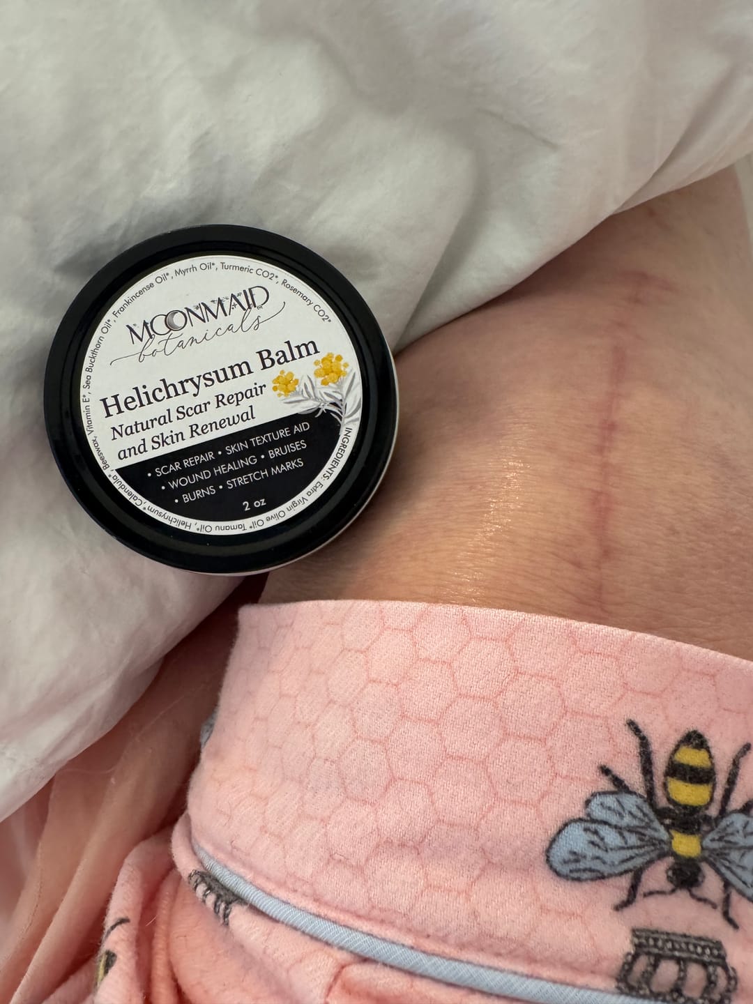 Customer photo review of Helichrysum Balm
