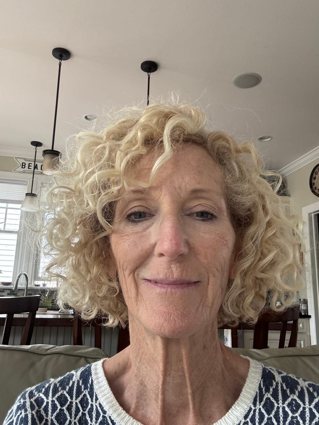 Customer photo review of 3 Month Supply - Seranova Micro Infusion System