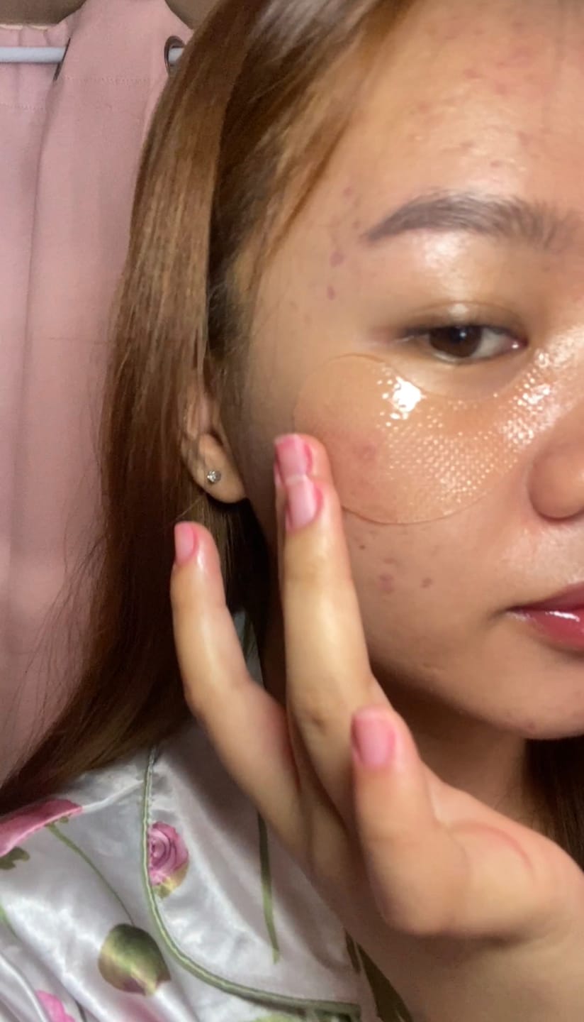 Customer photo review of Glutathione kojic acid eye patch Vita jelly