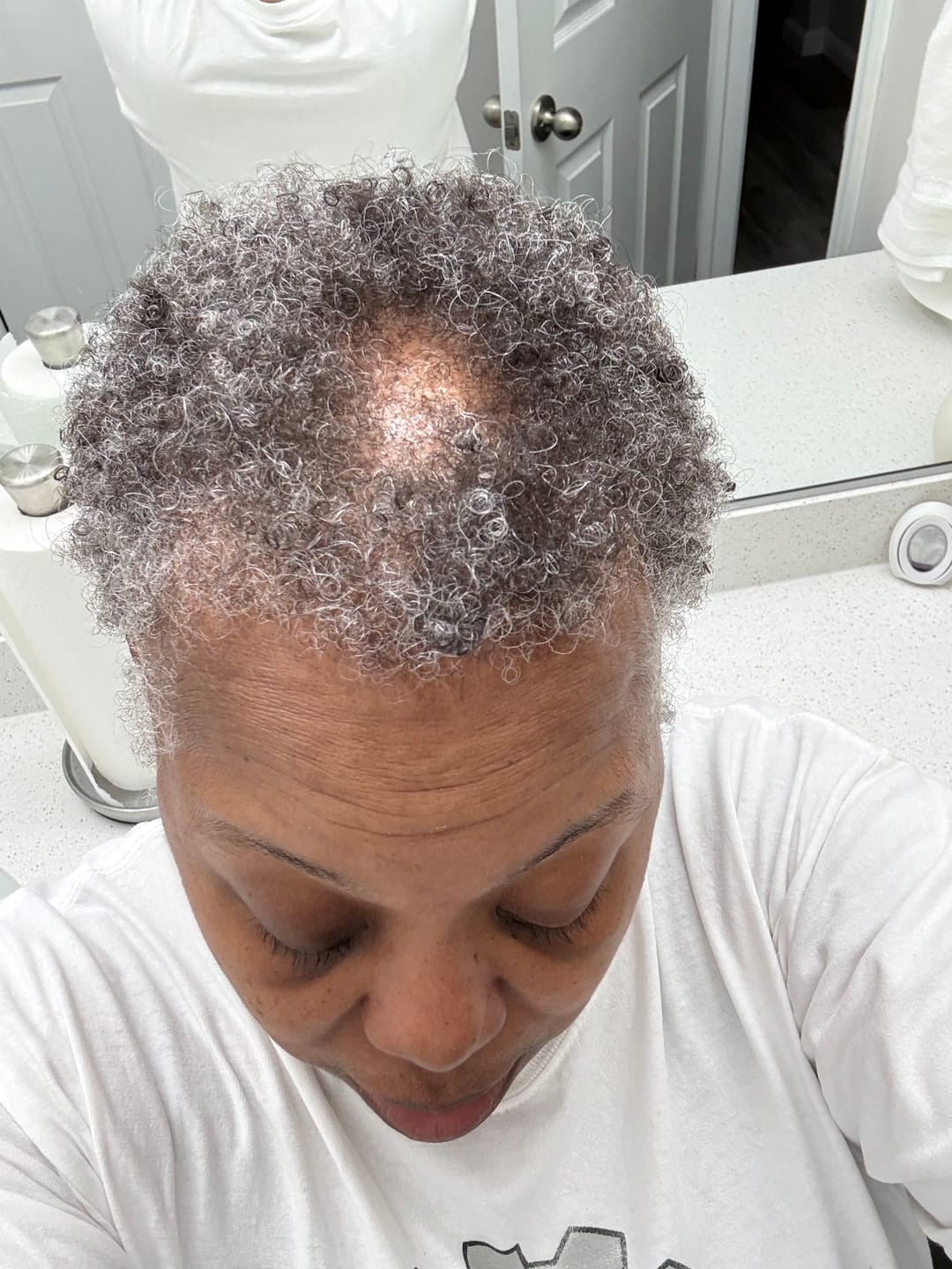Customer photo review of Healthy Hair Starter Kit- Limited Edition