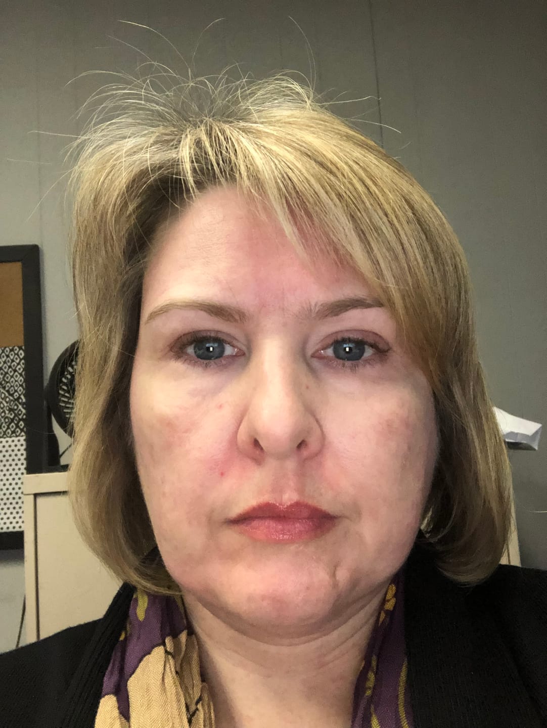 Customer photo review of Deep Collagen Cream