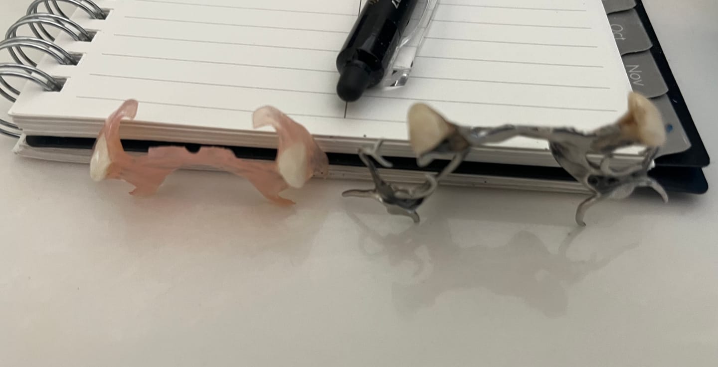 Customer photo review of Flexible Partial Denture
