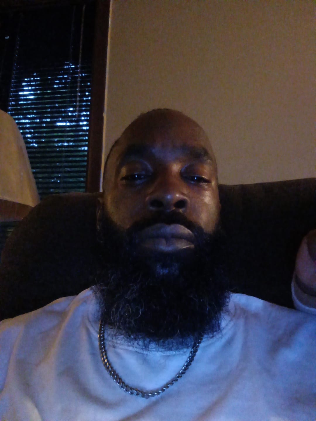 Customer photo review of Beard Growth Magic (Beard Growth Oil)