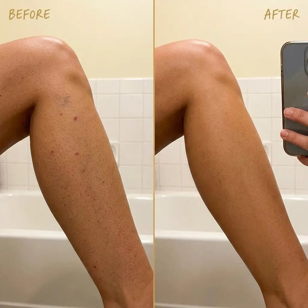 Customer photo review of Perfecteur de Teint Corps