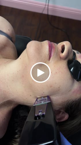 Customer video review of Replacement Cartridges for Metamorph Golden Youth Microneedling Machine