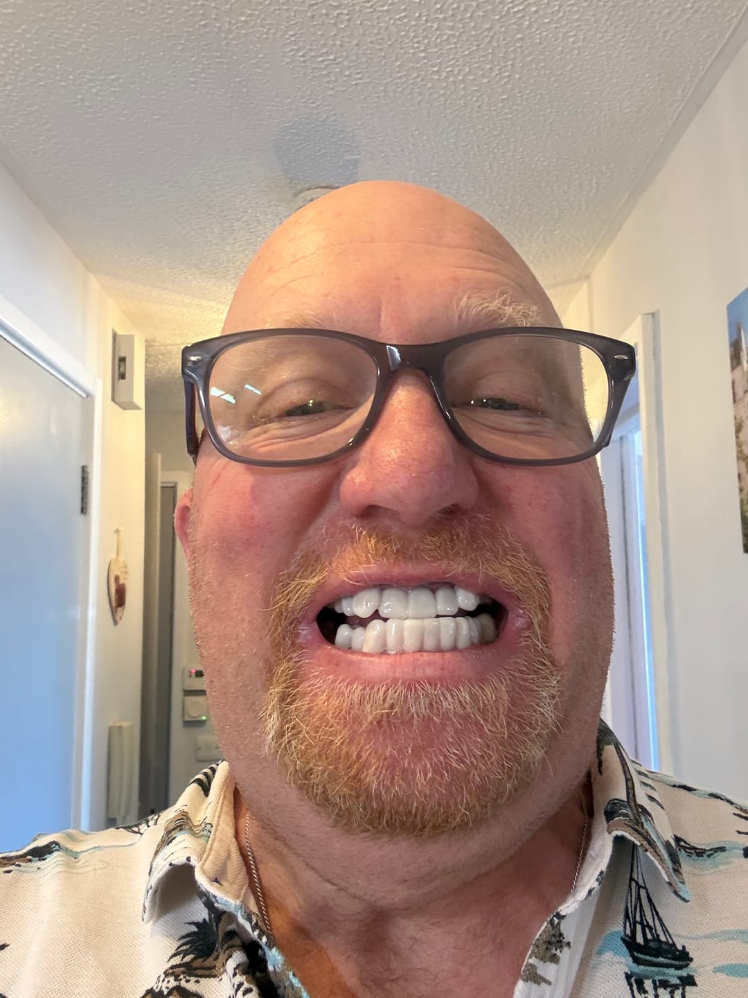 Customer photo review of Click-in Veneers 4.0