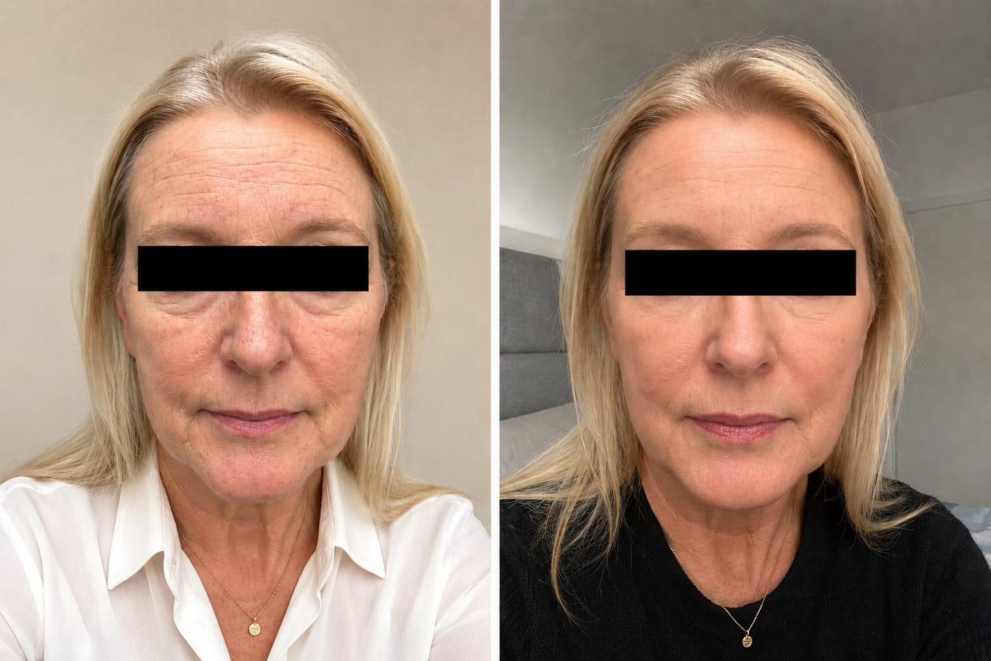 Customer photo review of Retinol Cream 0.3