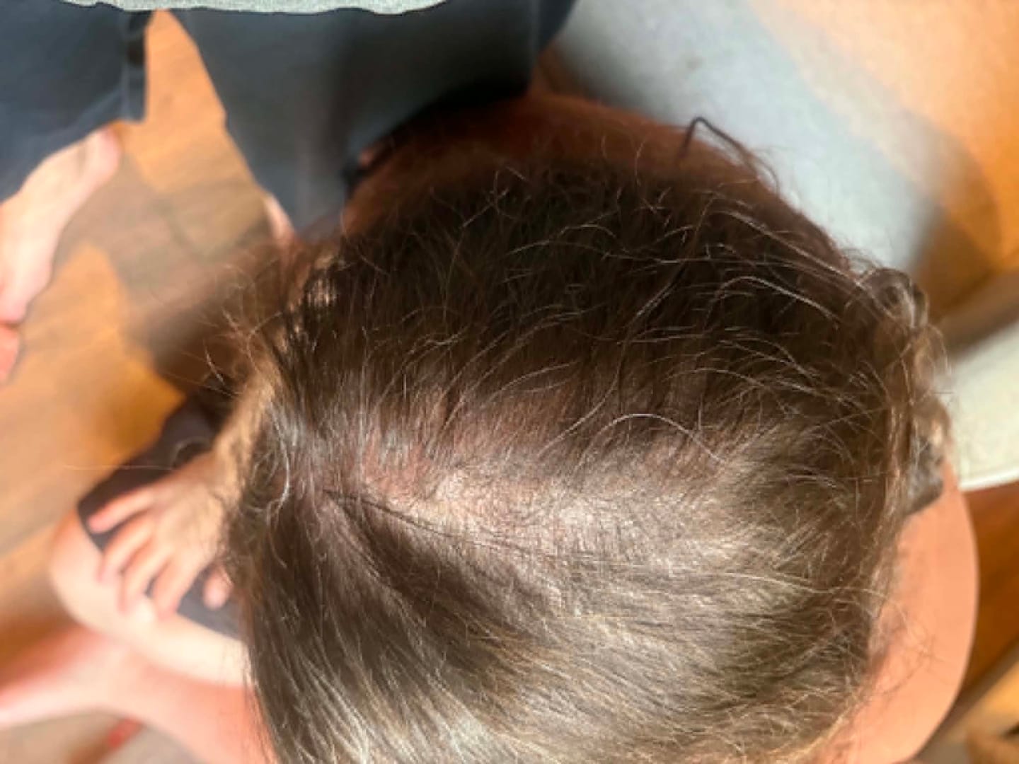 Customer photo review of SÉRUM NATUREL AU ROMARIN — LE SOIN CIBLÉ QUI AGIT PENDANT DES HEURES