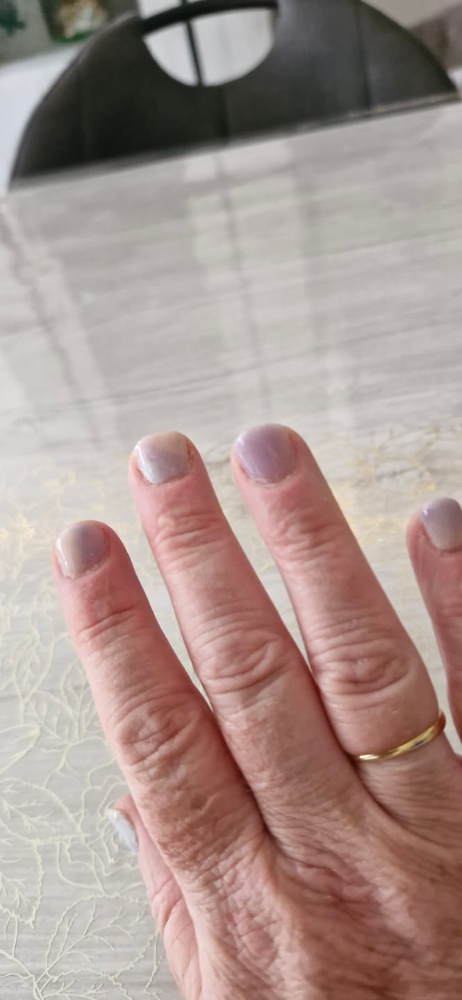 Customer photo review of Verzending Verzekering