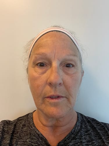 Reviewer showing their face before using The Complete System for Mature Women’s Skin.