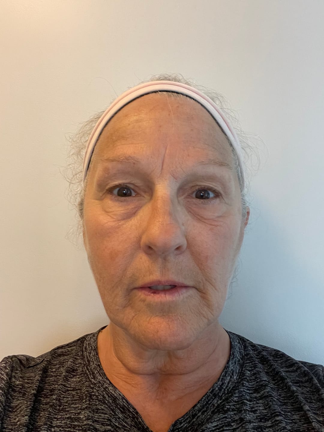Customer photo review of The Complete System for Mature Women’s Skin