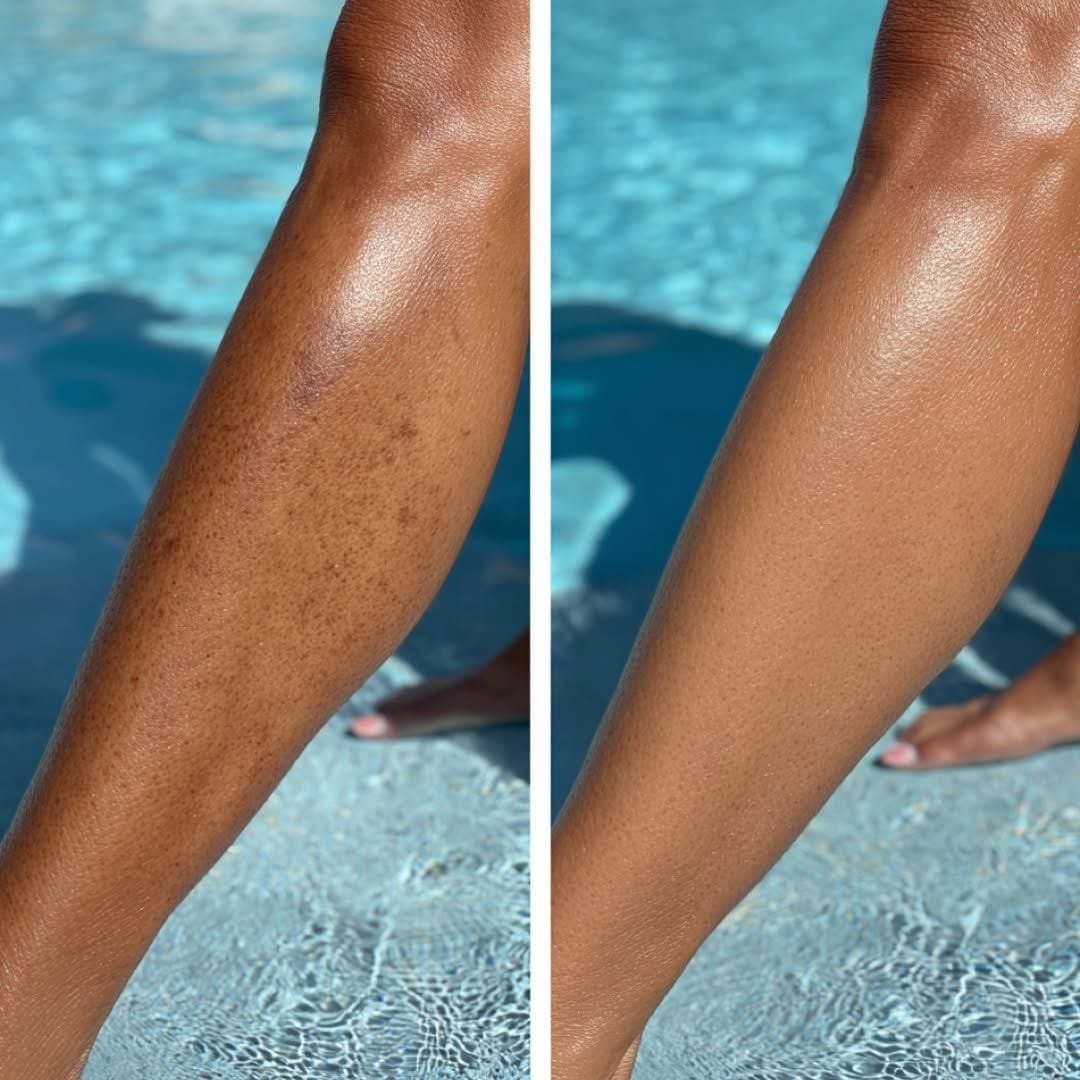 Customer photo review of Perfecteur de Teint Corps