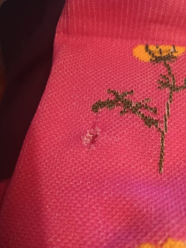 Customer's close-up of a hole in their pink floral Everyday Comfort Compression Socks.