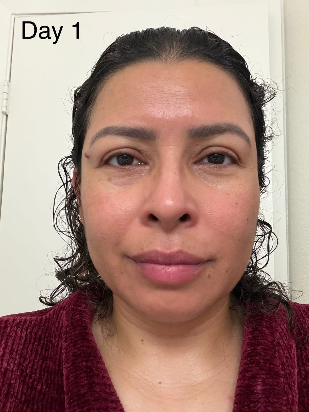 Customer photo review of THE DERMAL ARCHITECTURE PROTOCOL: COMPLETE SYSTEM