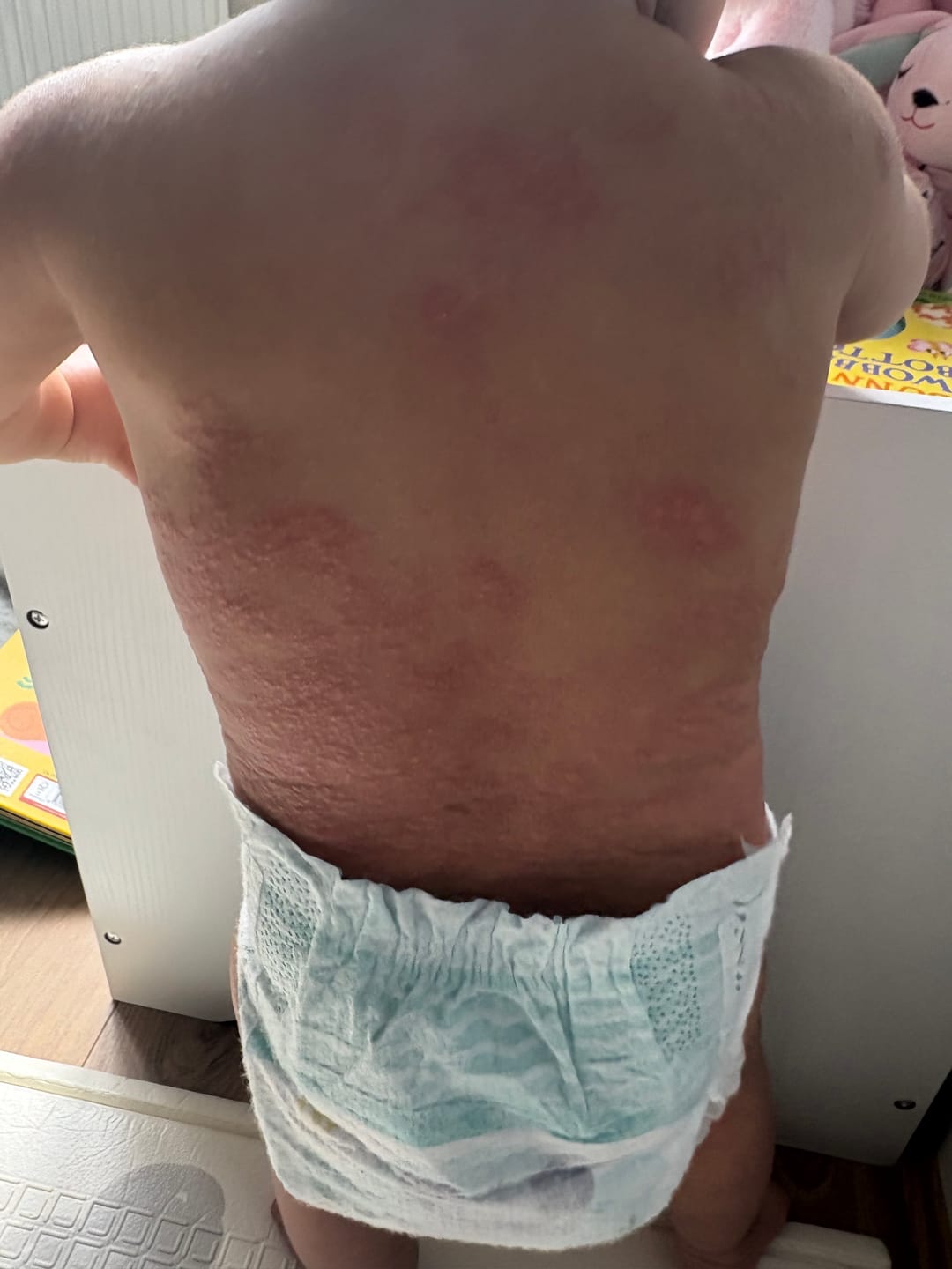 Customer photo review of Calm Balm
