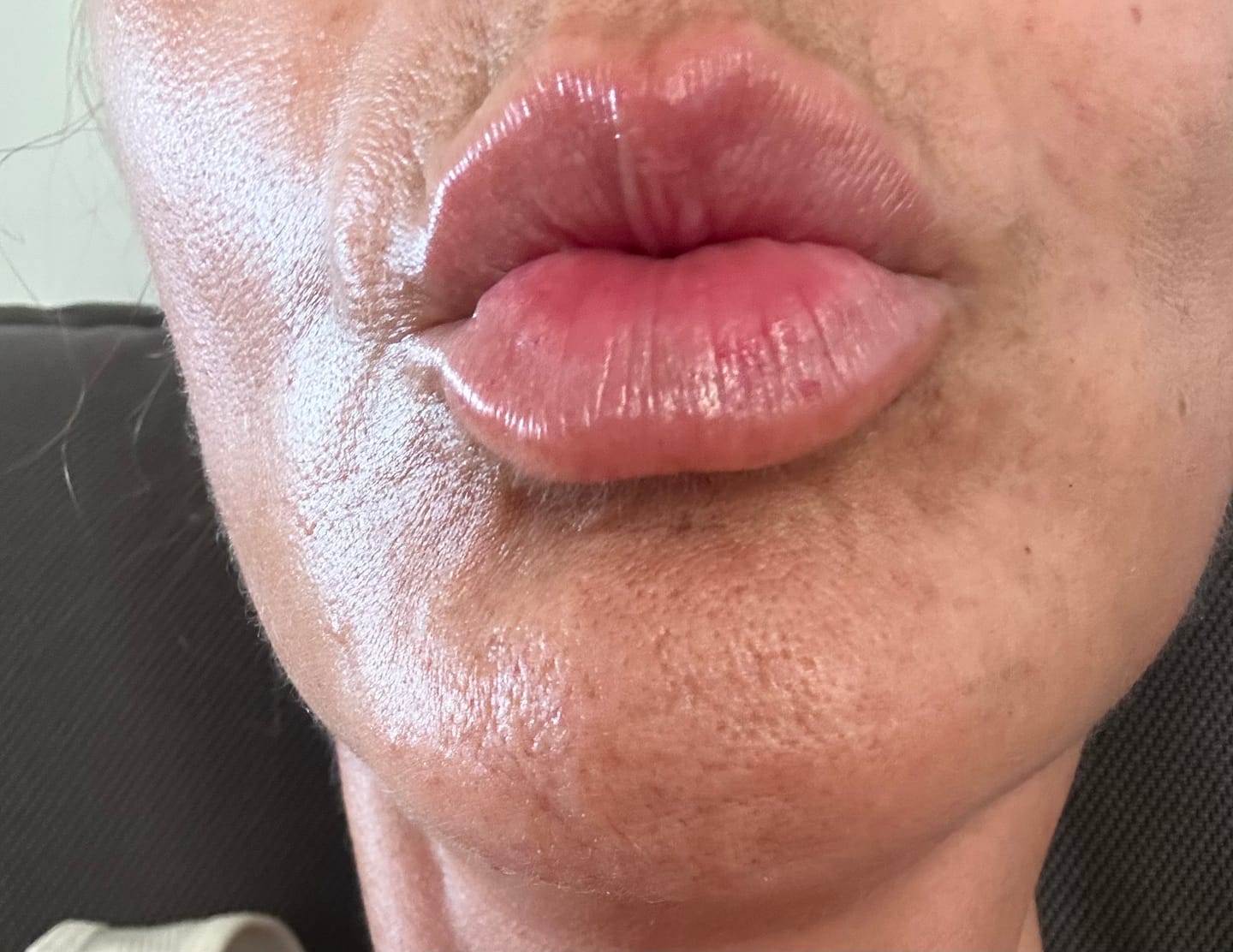 Customer photo review of Beelips / Reparador labial