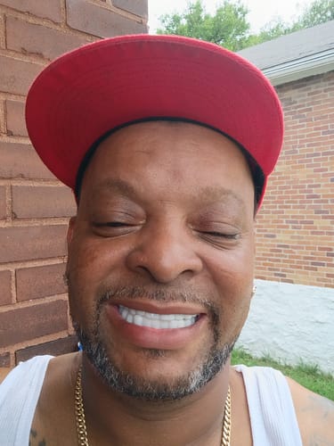 Customer smiling happily to show their bright white Pop On Veneers.