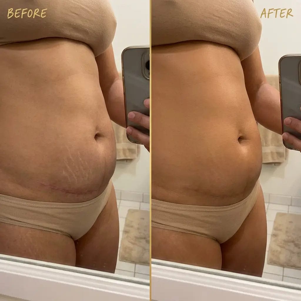 Customer photo review of Perfecteur de Teint Corps