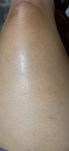 Customer photo review of NØRD BODY Anti-Cellulite Massage Oil (o4)