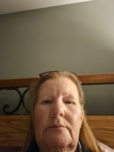 Customer's close-up photo showing their facial skin for a Koriderm™ Time Reverse Cream review.