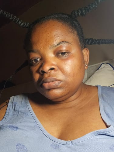 Customer photo review of NEW Glycolic Acid Face Serum
