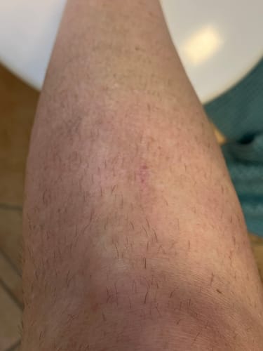Bein eines Kunden mit kurzen Stoppeln vor der Anwendung des Haarentfernungsschaums.