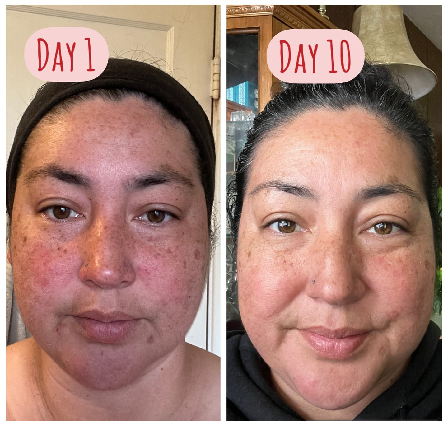 Customer photo review of Uncontroversial Face Care Bundle