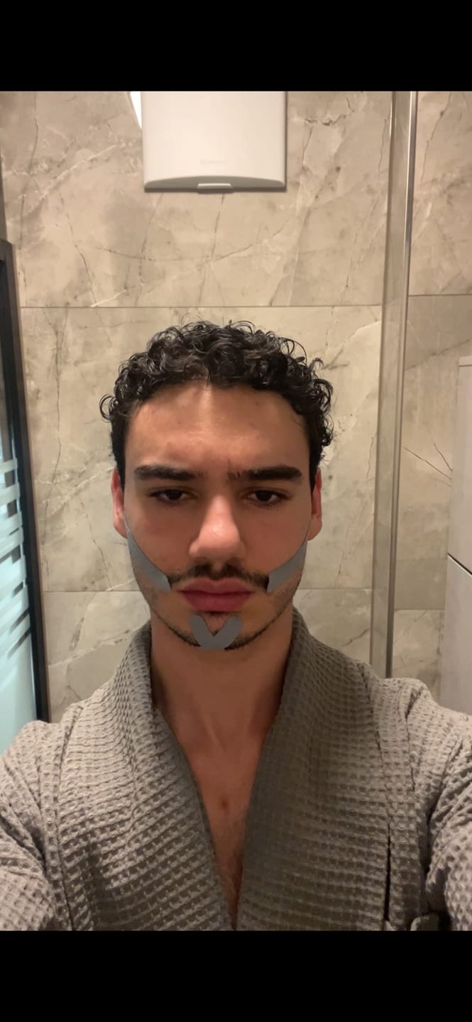 Customer photo review of Zygo Tape - Facial Sculpting & Anti-Aging Tape