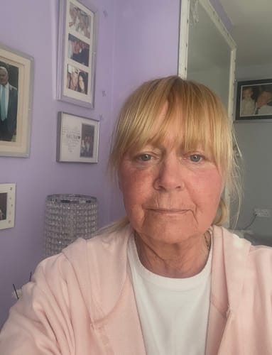 Reviewer selfie showing her facial skin after using the Vitamin Boost Duo in a purple room.