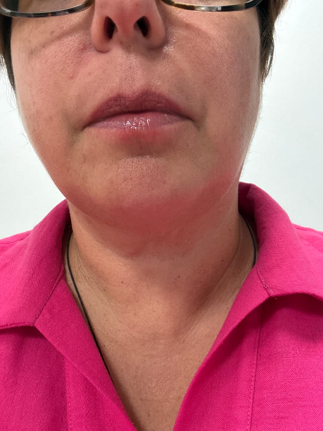 Customer photo review of SOENTJIES® FullPout Hydrating Balm