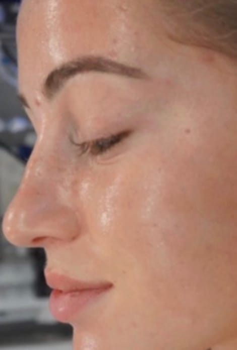 Customer photo review of Hyaluron Gesichtsmaske