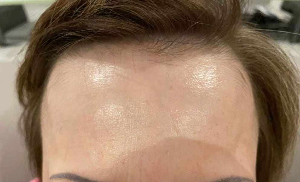 Customer photo review of Hyaluron Gesichtsmaske