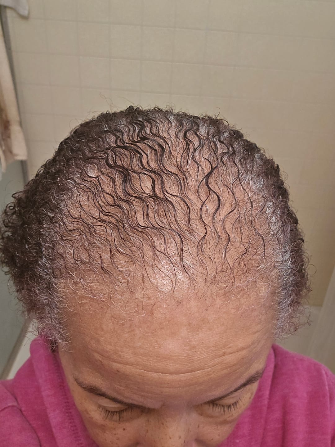 Customer photo review of BALM- Stimulating Scalp and Hair Balm