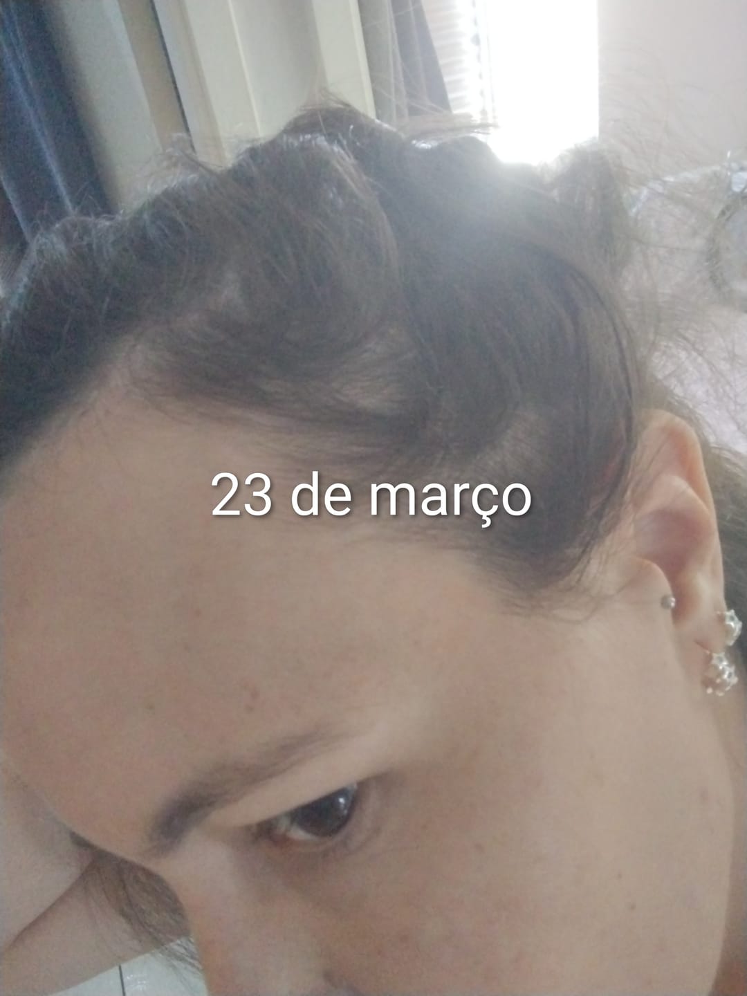 Customer photo review of 1 Pote Colágeno Com Ácido Hialurônico