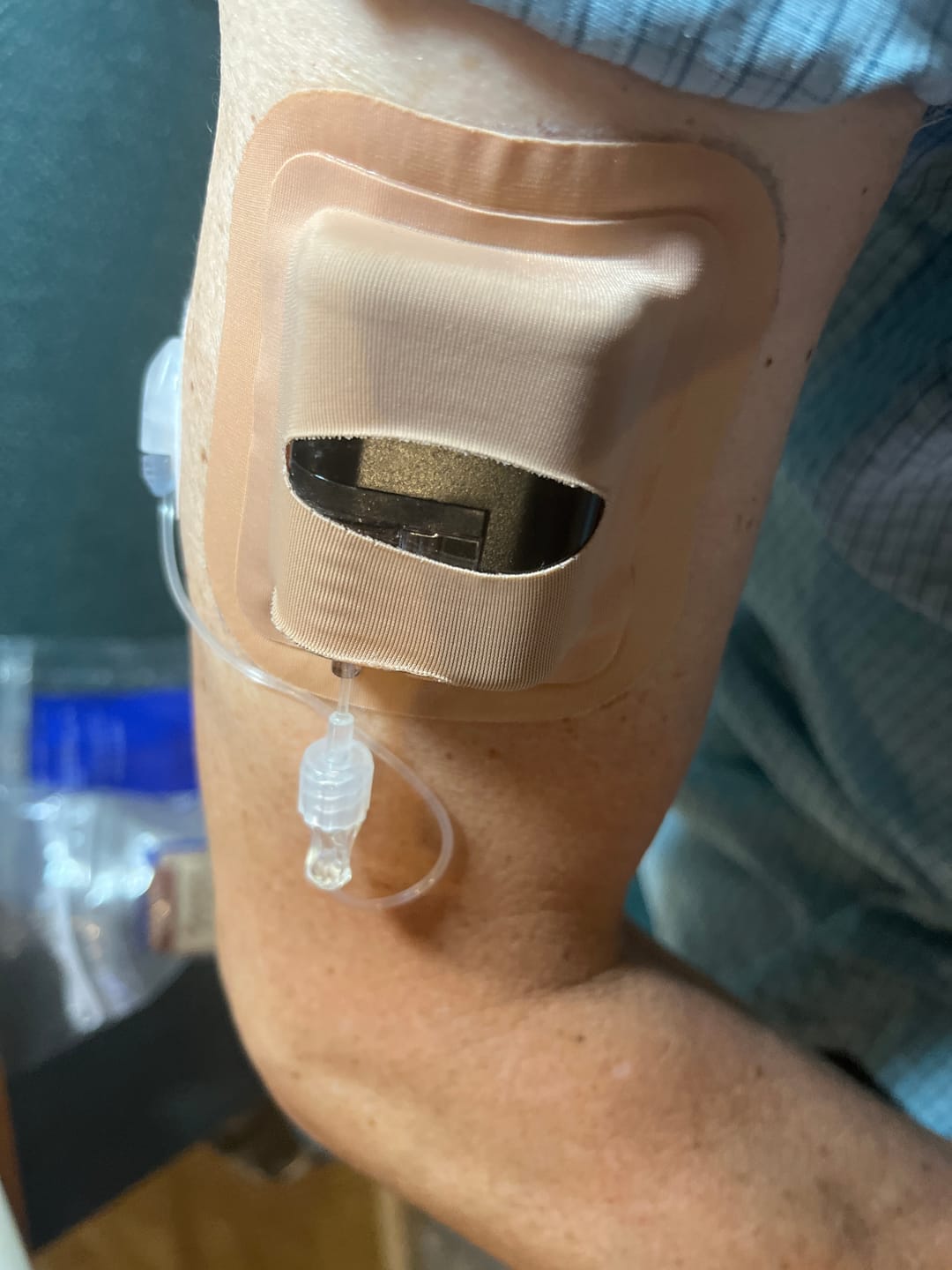 Customer photo review of Skin Grip - Tandem Mobi Pocket Patch
