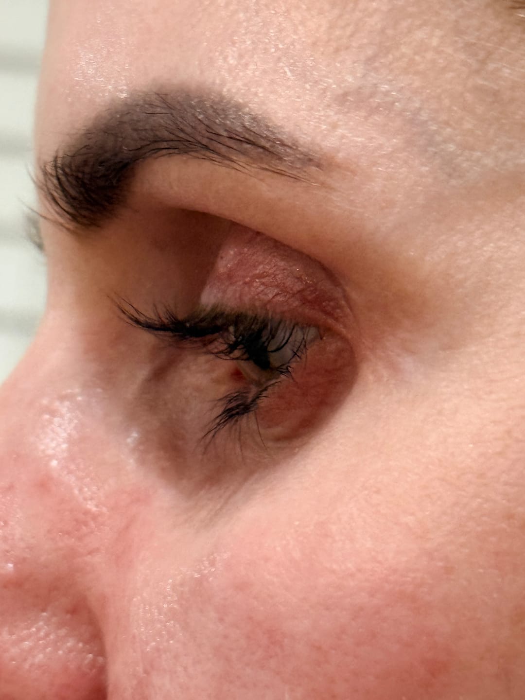 Customer photo review of Enhance® - Eyelash Growth Serum