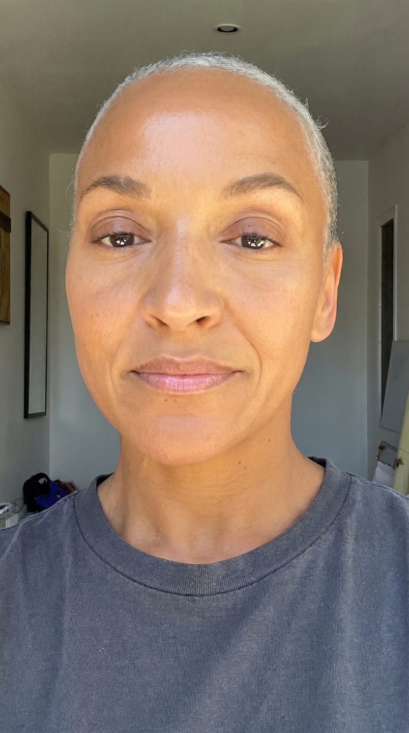 Customer photo review of The Micro Infusion System™ For Melanin-Rich Skin