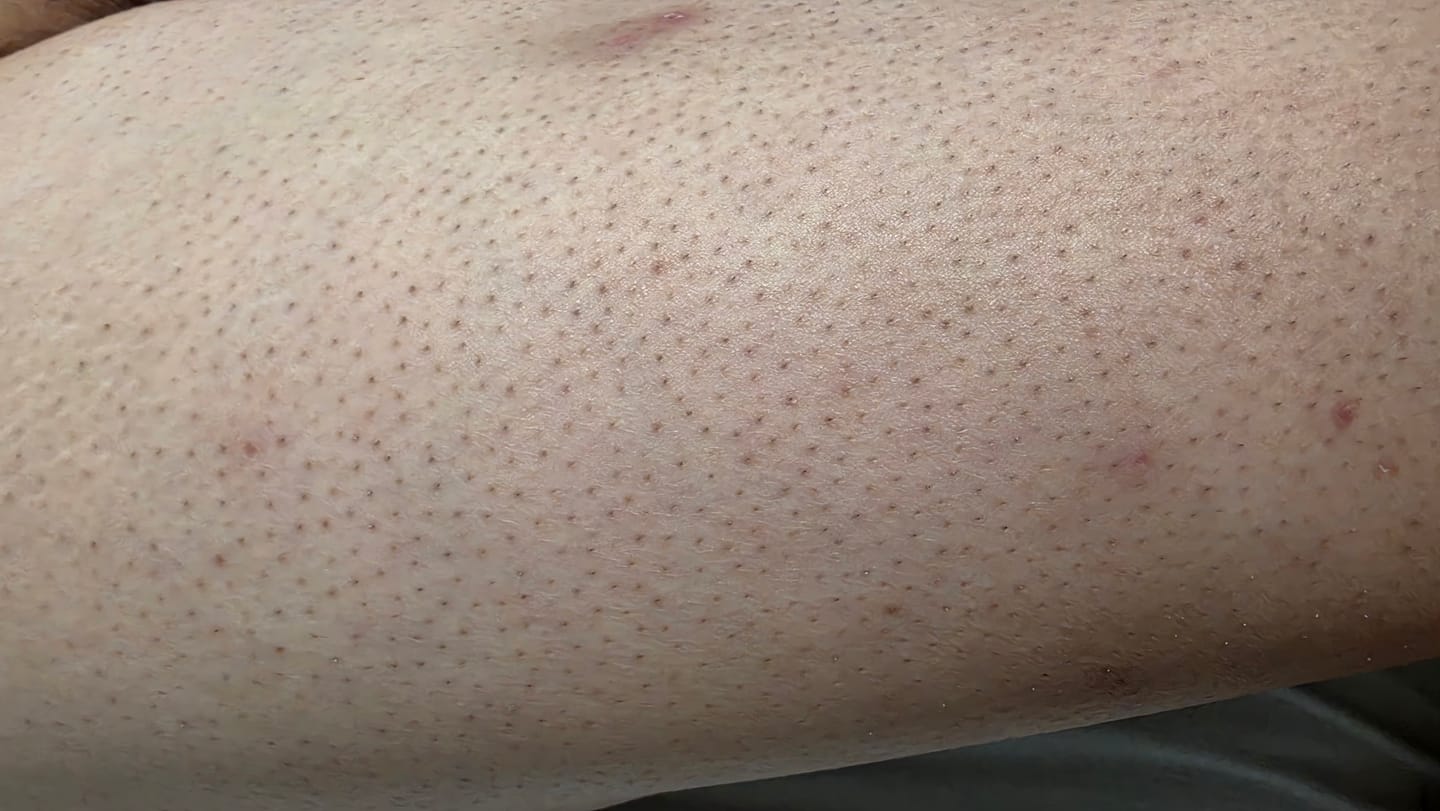 Customer photo review of Ulike Air10家用除毛儀-限時優惠