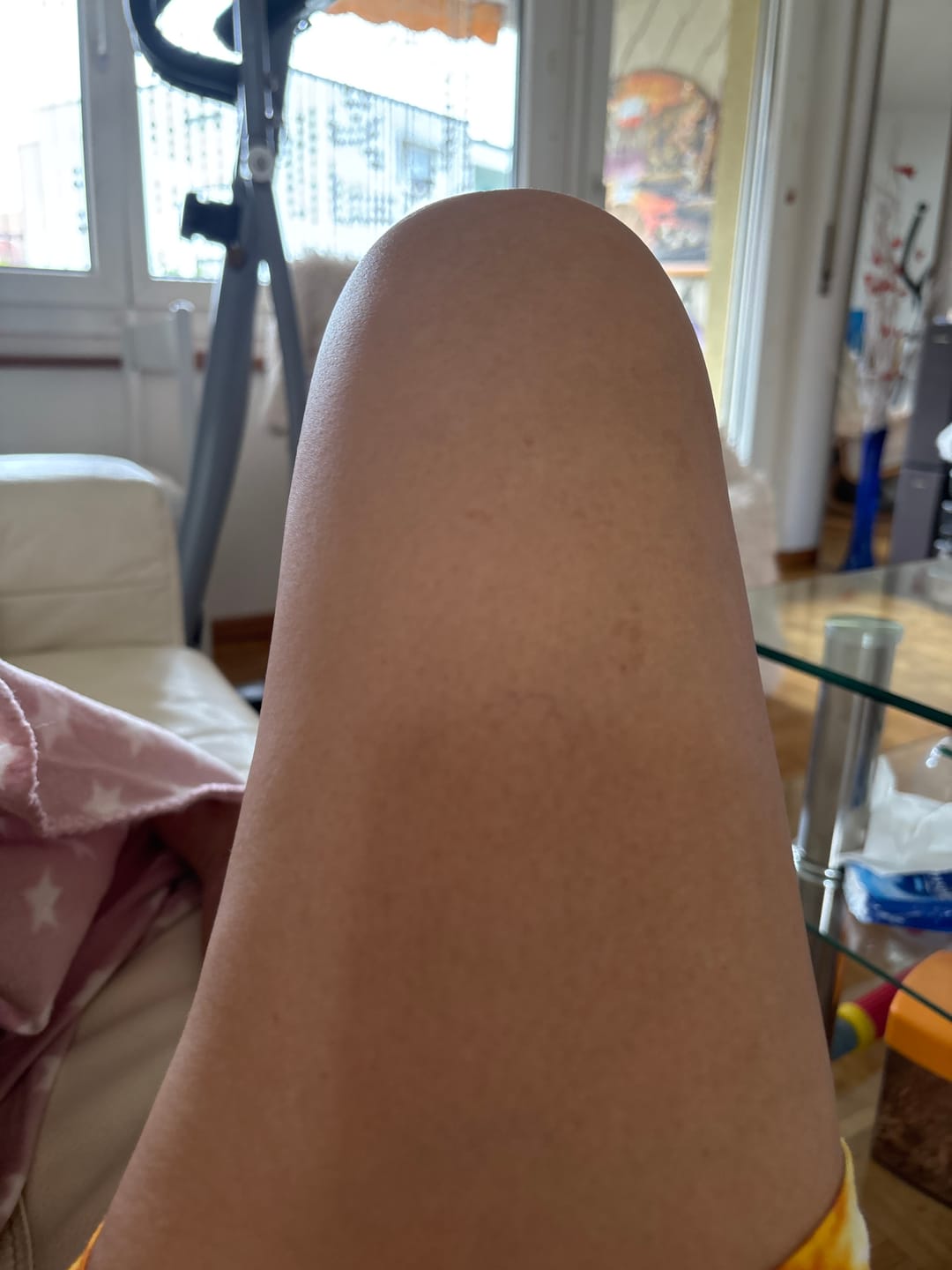 Customer photo review of CelluLuxe-Pro Du schaust in den Spiegel – und erkennst deine Haut kaum wieder