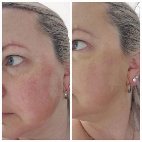 Customer photo review of GRATIS samples – exclusief voor nieuwe klanten
