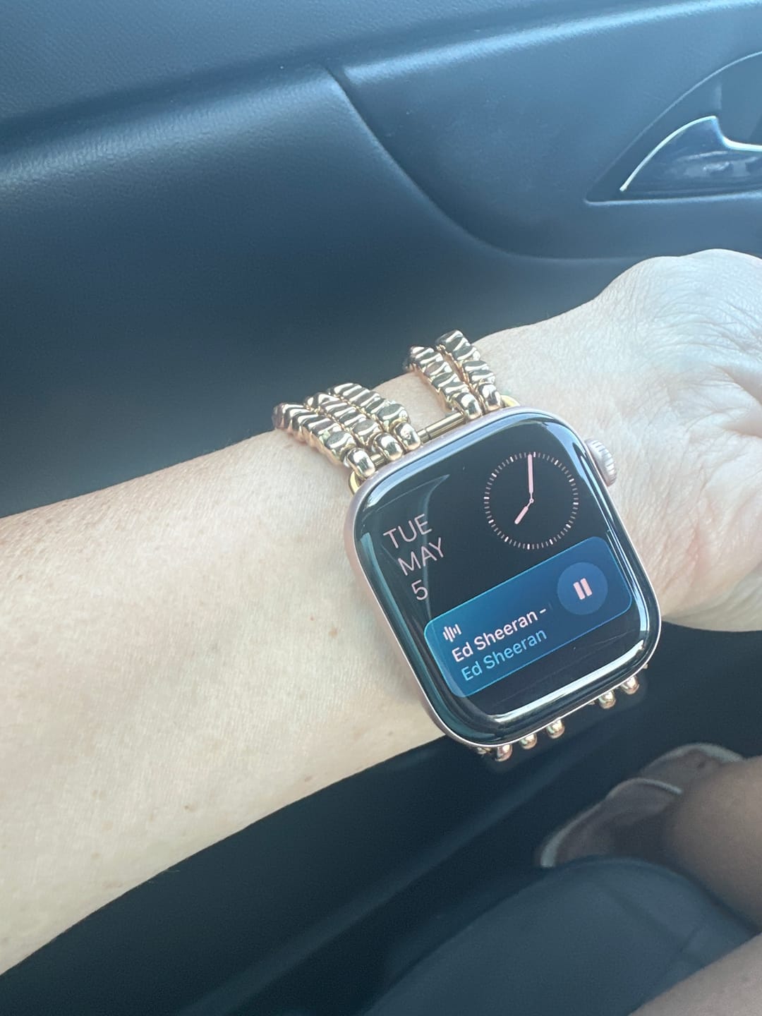 Customer photo review of Mirrorball Watch Band for Apple Watch