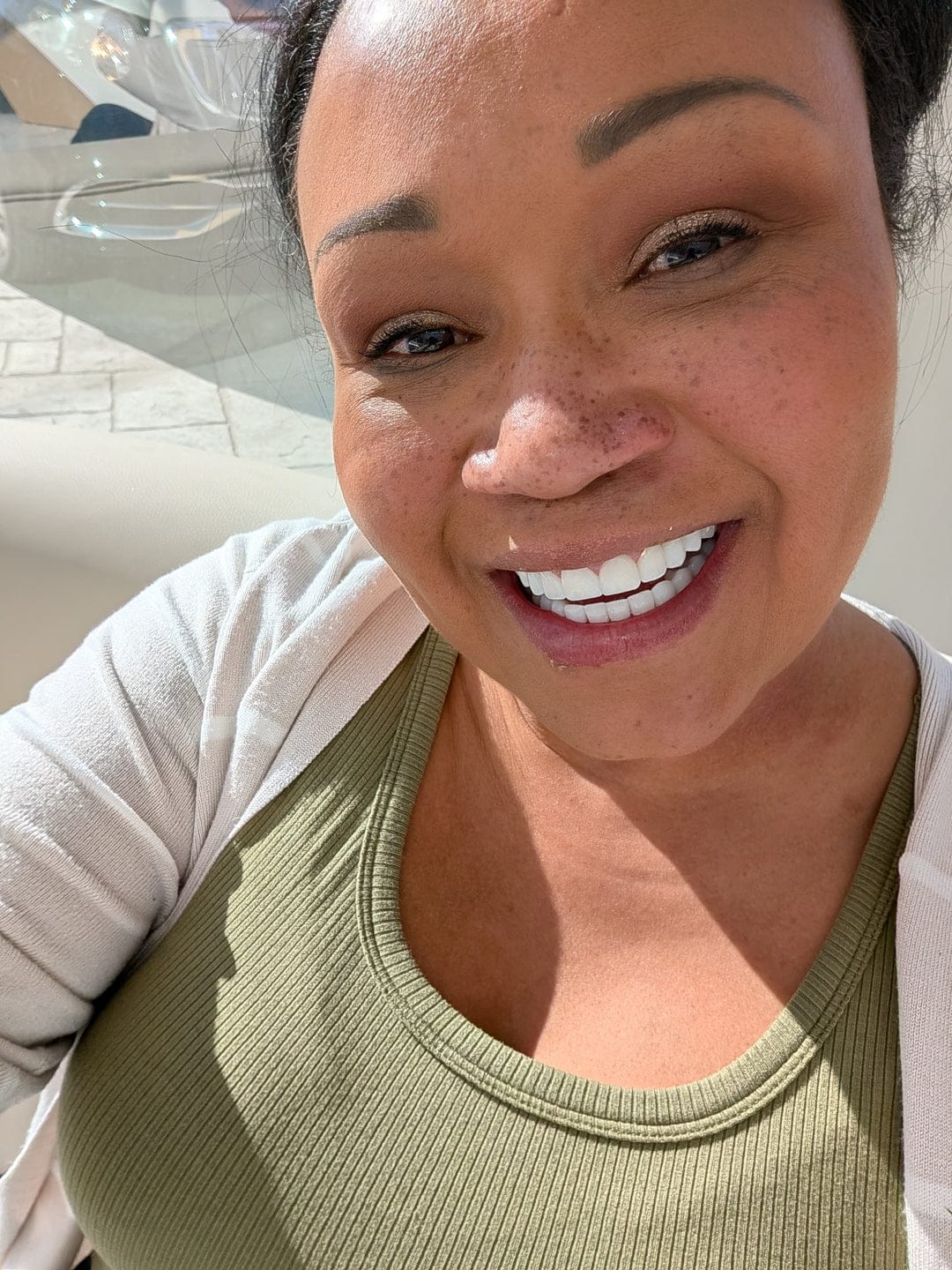 Customer photo review of The Micro Infusion System™ For Melanin-Rich Skin